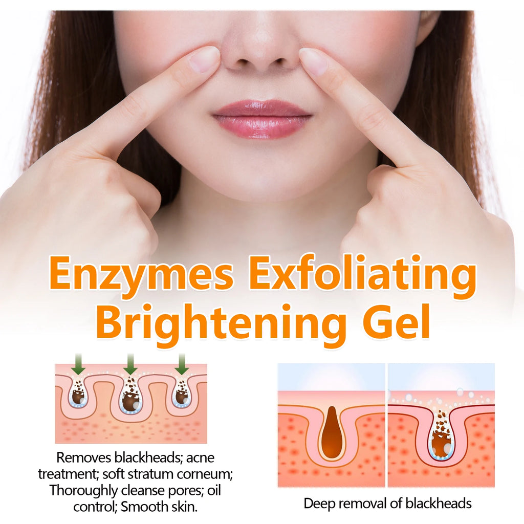 HOYGI Orange Exfoliating Gel Gentle Cleansing Dead Spot Remover Reduce Blackheads Smooth Brightening for All Skin Types Care