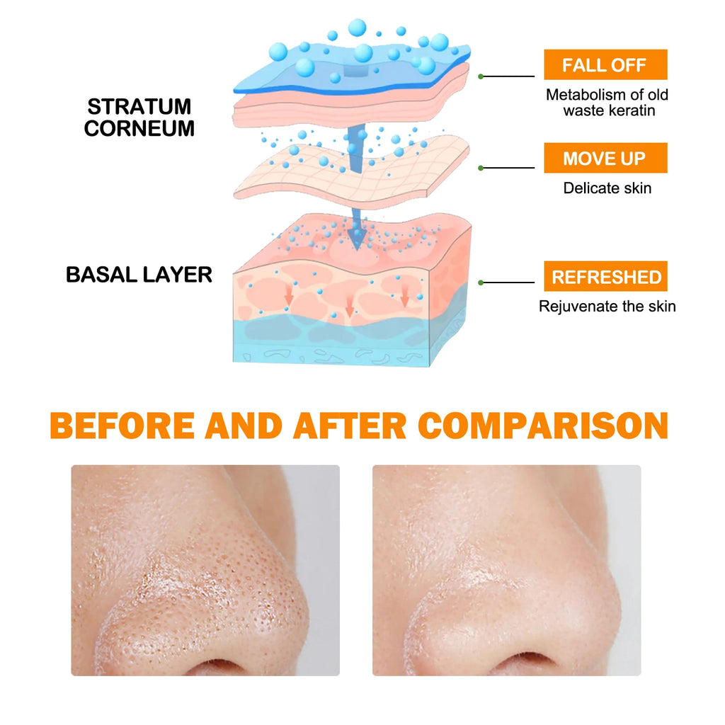 HOYGI Orange Exfoliating Gel Gentle Cleansing Dead Spot Remover Reduce Blackheads Smooth Brightening for All Skin Types Care
