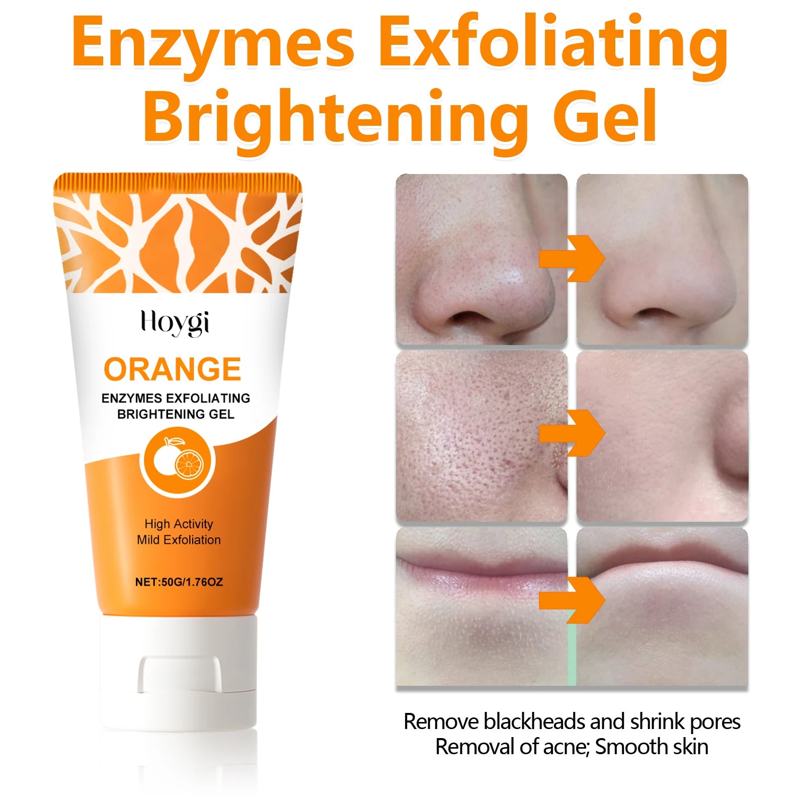 HOYGI Orange Exfoliating Gel Gentle Cleansing Dead Spot Remover Reduce Blackheads Smooth Brightening for All Skin Types Care